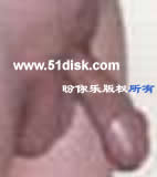 勃起阴茎
